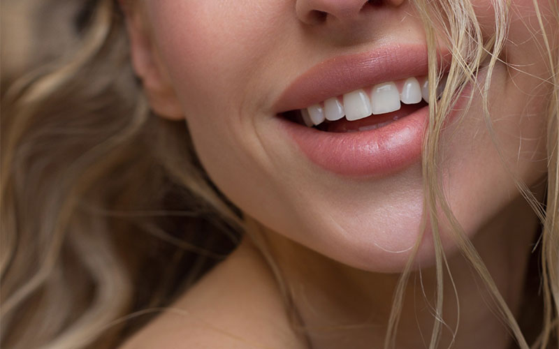 gummy_smile